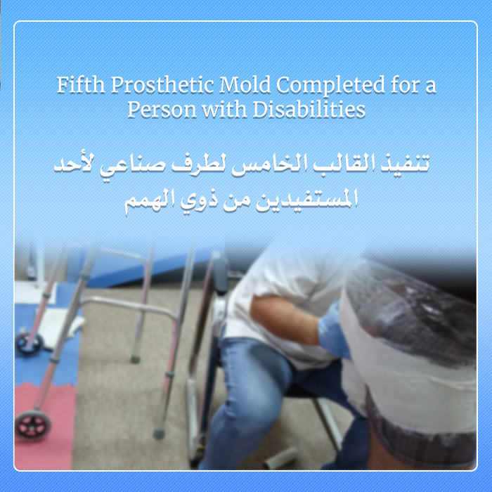 تنفيذ القالب الخامس لطرف صناعي لأحد المستفيدين من ذوي الهمم